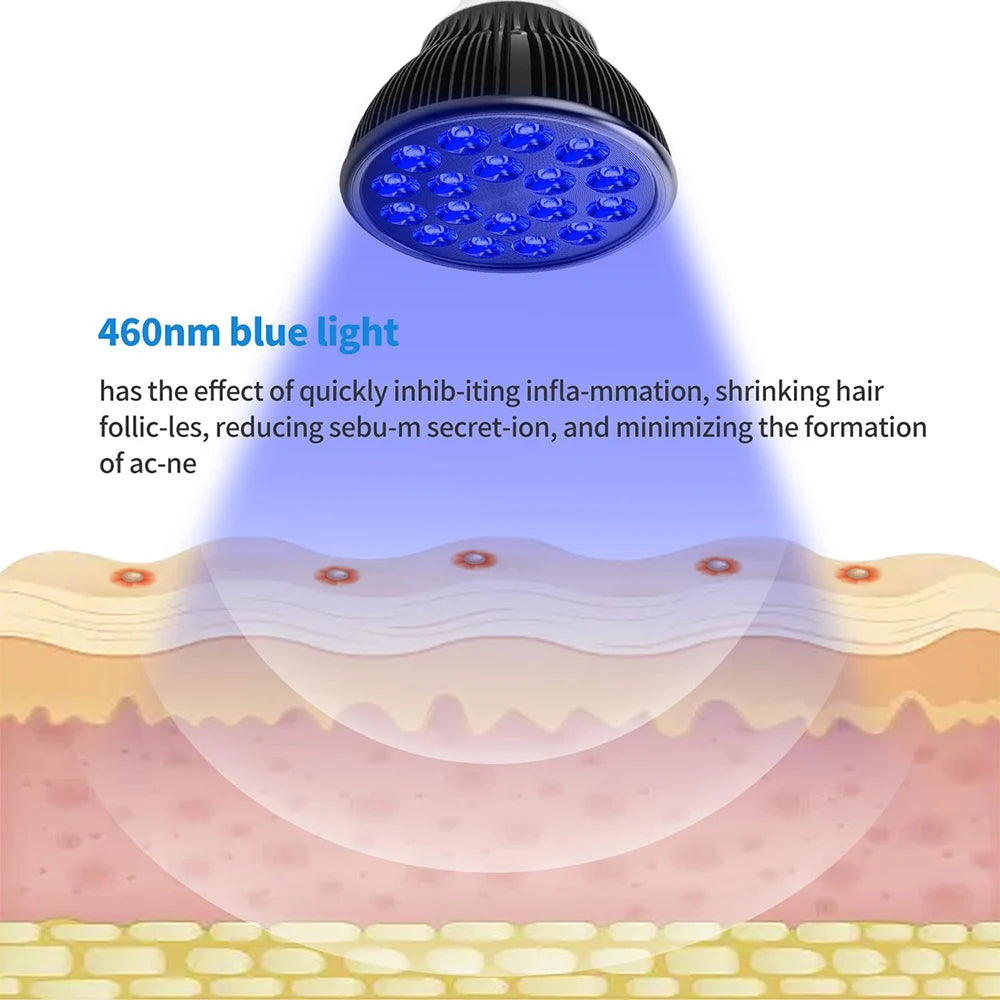 18-LED 460nm Blue Light Therapy Lamp – Face & Body Skin Care Blue Light Therapy Lamp Qst