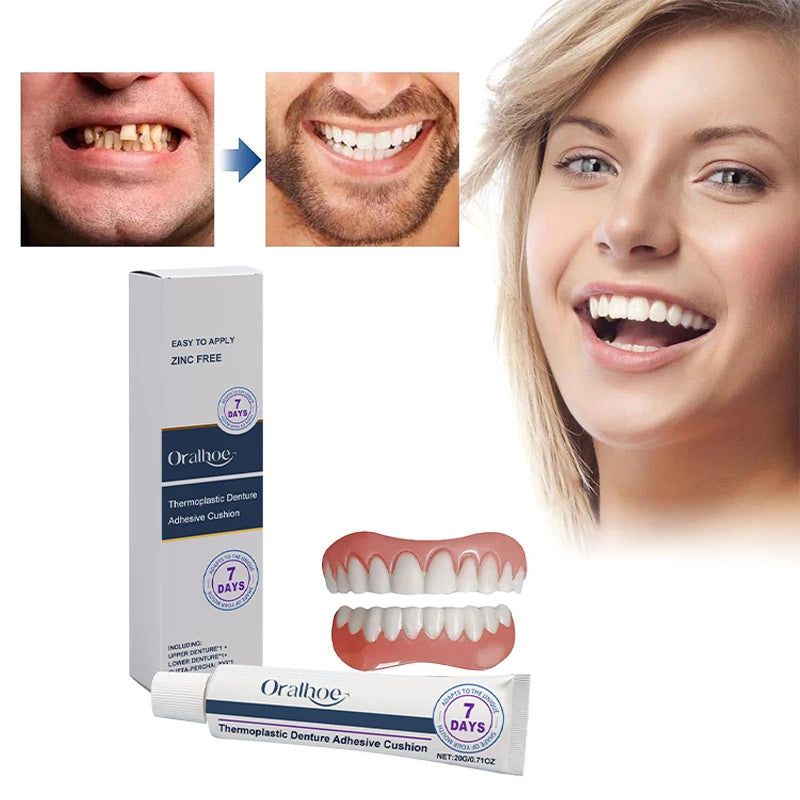 Silicone Denture Reliner Kit – Temporary Adhesive Brace Set Denture Reliner Kit Qst
