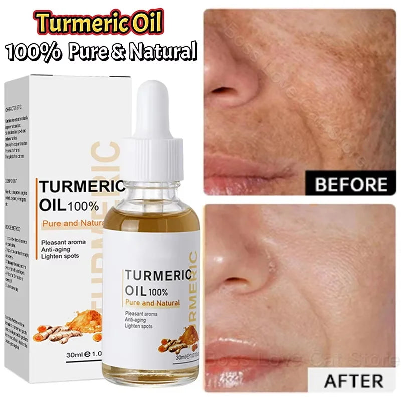 Turmeric Repair Essence – Brightens Dark Spots & Moisturizes Brightening Face Serum Qme