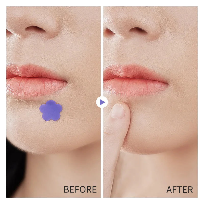 Colorful Star-Shaped Pimple Patches – Invisible Acne Stickers Acne Patch Qst