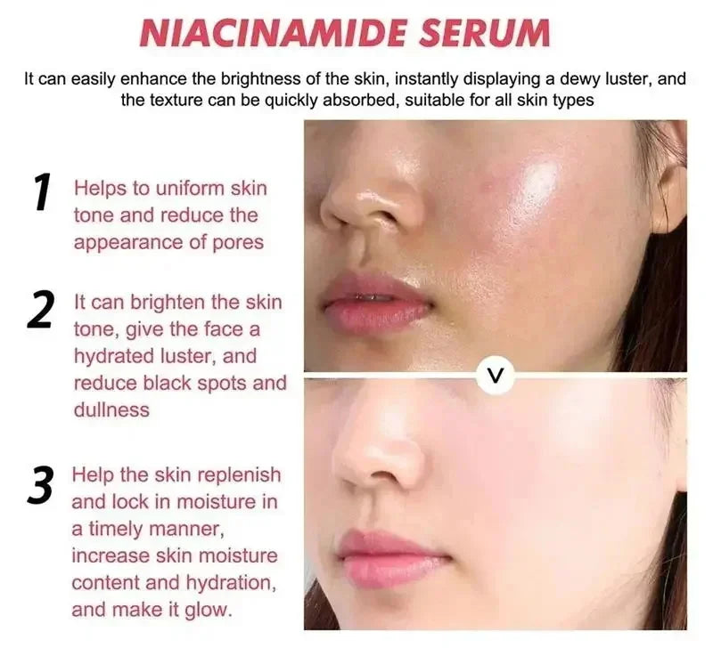 Niacinamide Dark Spot Correcting Face Serum | Brightening Brightening Face Serum Qme