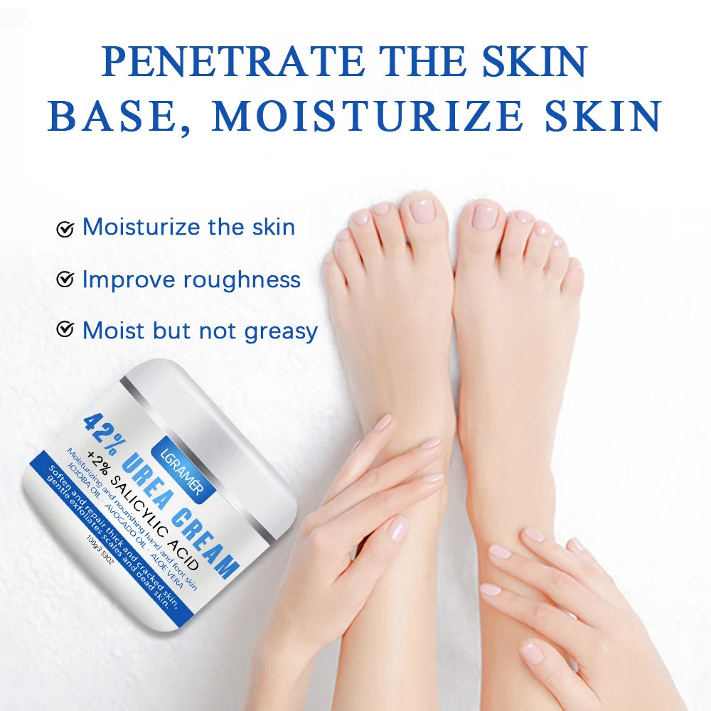 YOUNGCOME 42% Urea Hand & Foot Cream – Deep Moisturizer Foot & Hand Cream Qst