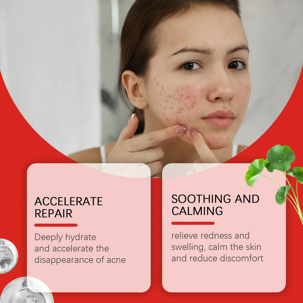 Salicylic Acid Pimple Patches – Colorful Heart Flower Star | Qme Pimple Patches Qme