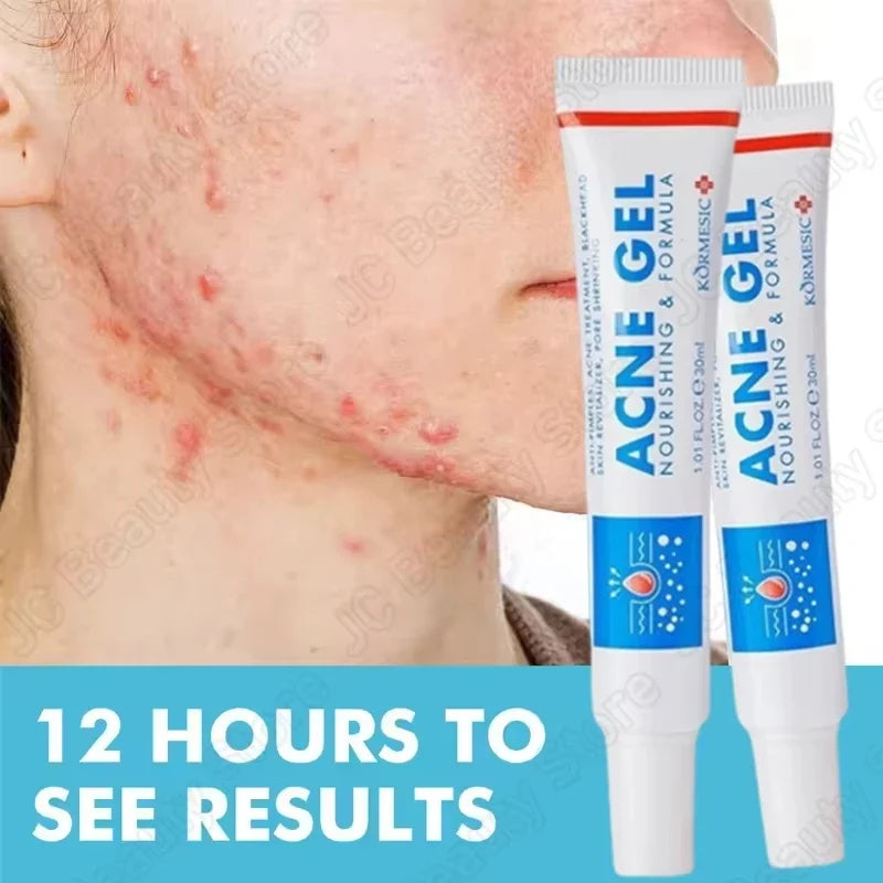 Salicylic Acid Face Cream – Oil Control & Pore-Clearing Moisturizer Salicylic Acid Face Cream Qme