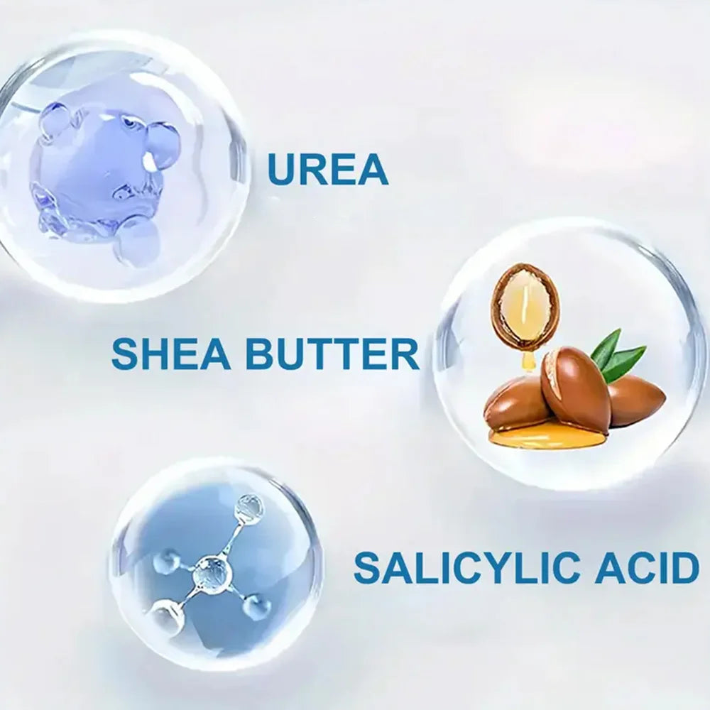 YOUNGCOME 60% Urea & 2% Salicylic Acid Foot Cream Foot Cream Qst