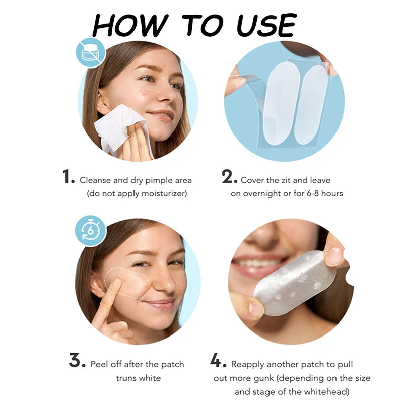 40-Piece Invisible Blemish Patches – Spot Concealer Stickers Blemish Spot Patches Qst