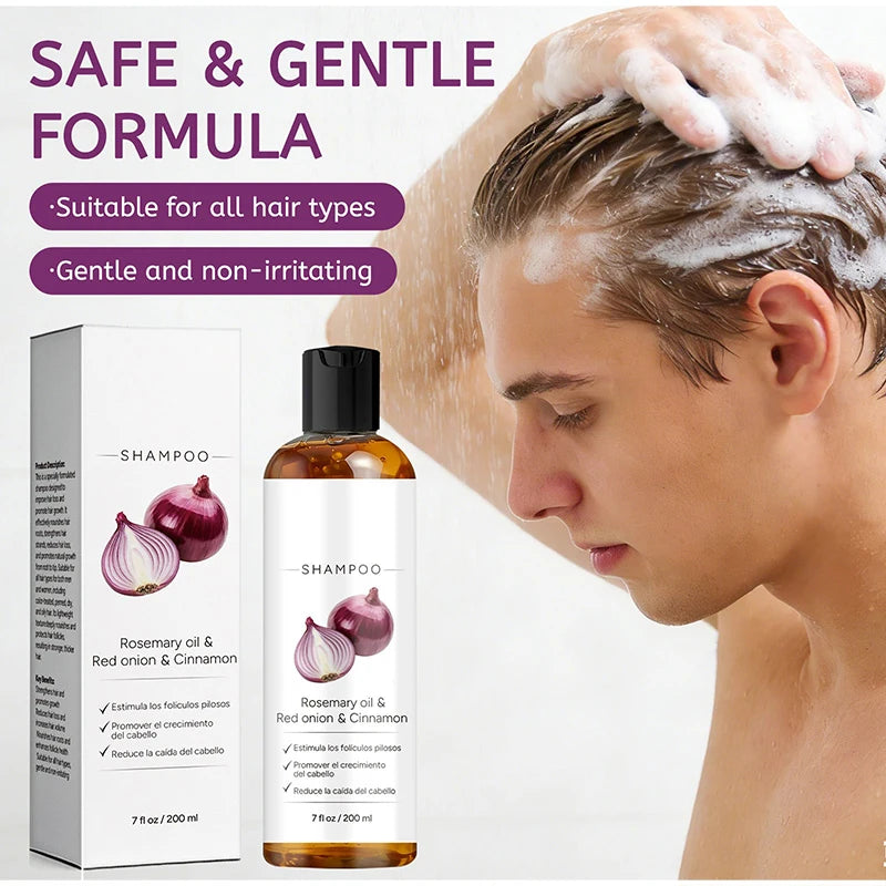 WARMKISS Biotin Rosemary Onion Thickening Shampoo | All Hair Thickening Shampoo Qst