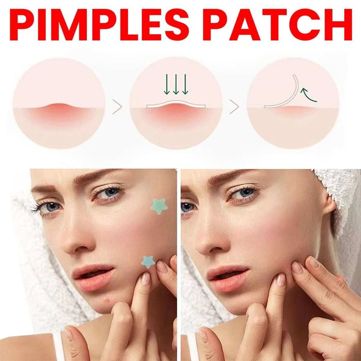 200pcs Star Acne Pimple Patches – Colorful Breathable Blemish Dots Acne Pimple Patch Qst
