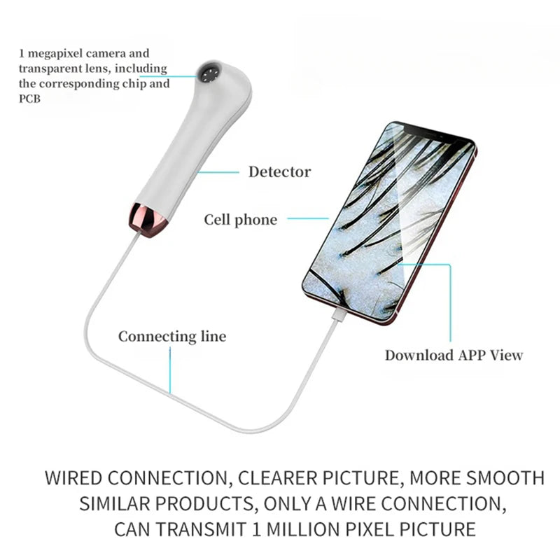HD Scalp & Hair Follicle Analyzer – OTG Skin Magnifier Scalp Skin Analyzer Qst