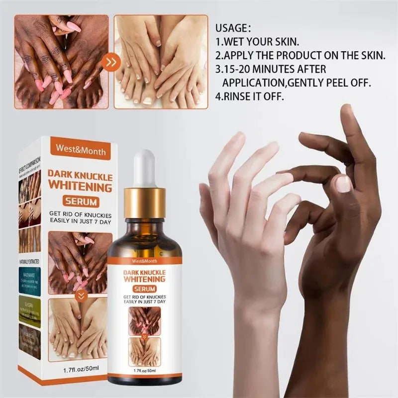 Skin Brightening Essence – Knuckle, Elbow & Knee Serum 50ml Brightening Body Serum Qst