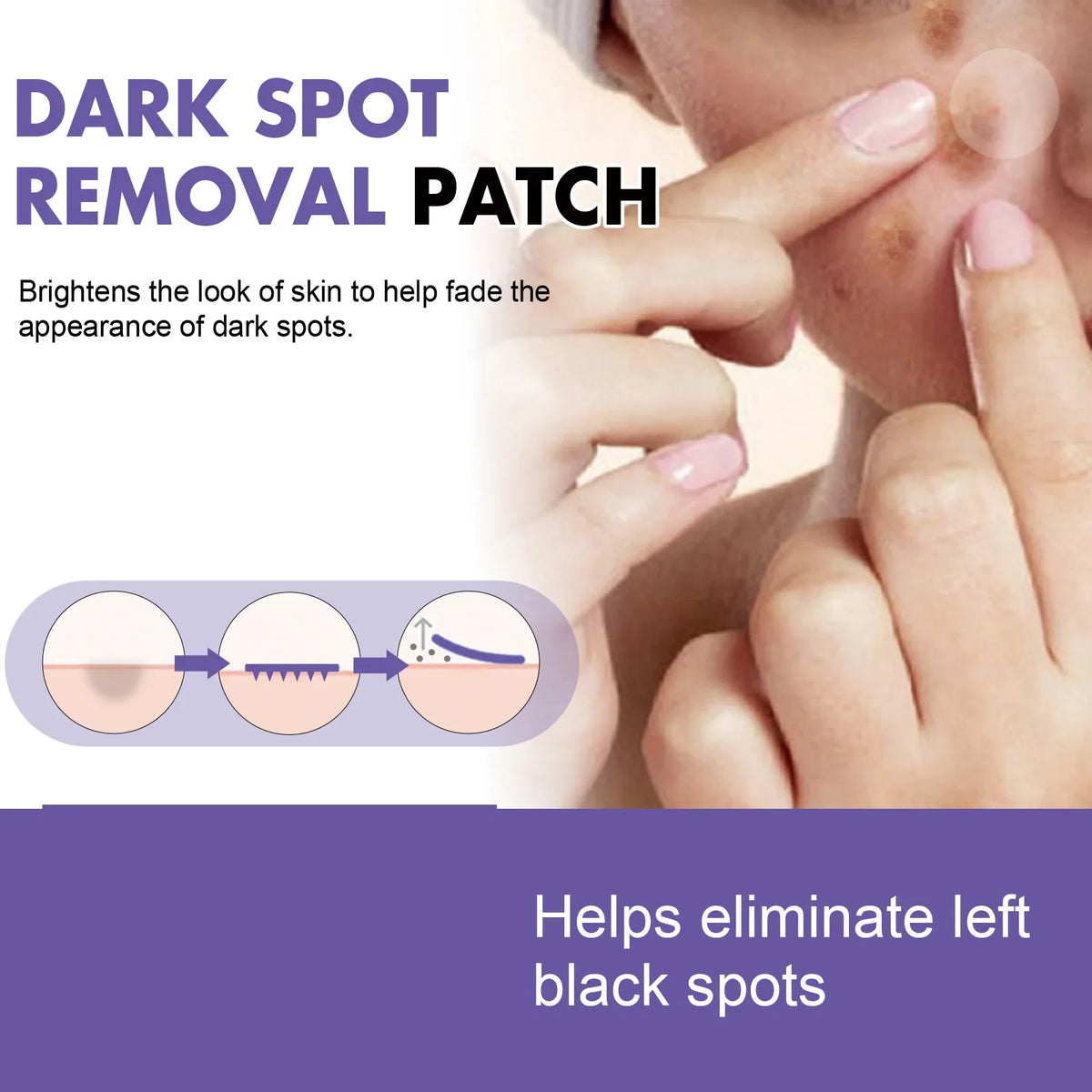Dark Spot Correcting Patches & Acne Concealer – 4 Shades Acne Concealer Patch Qme