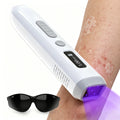 308nm UVB Handheld Narrow Band UV Light Therapy Device UV Light Therapy Device Qst 1 set