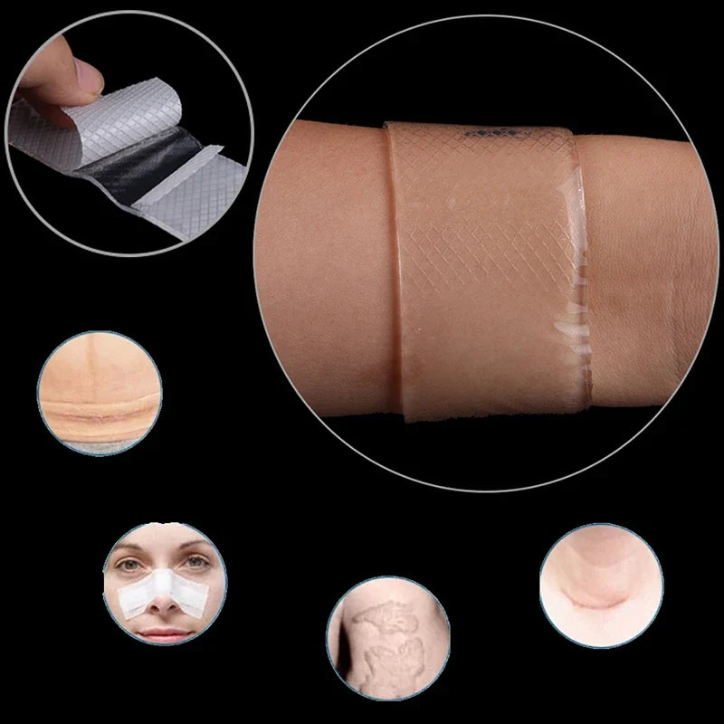 Reusable Silicone Scar Gel Patch – Skin Smoothing Sheet Silicone Scar Patch Qme