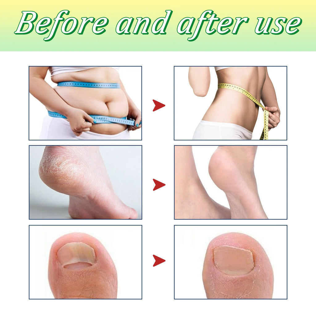 10pcs Herbal Fizzy Foot Bath Tablets – Ginger & Angelica Spa Soak Foot Bath Tablets Qst
