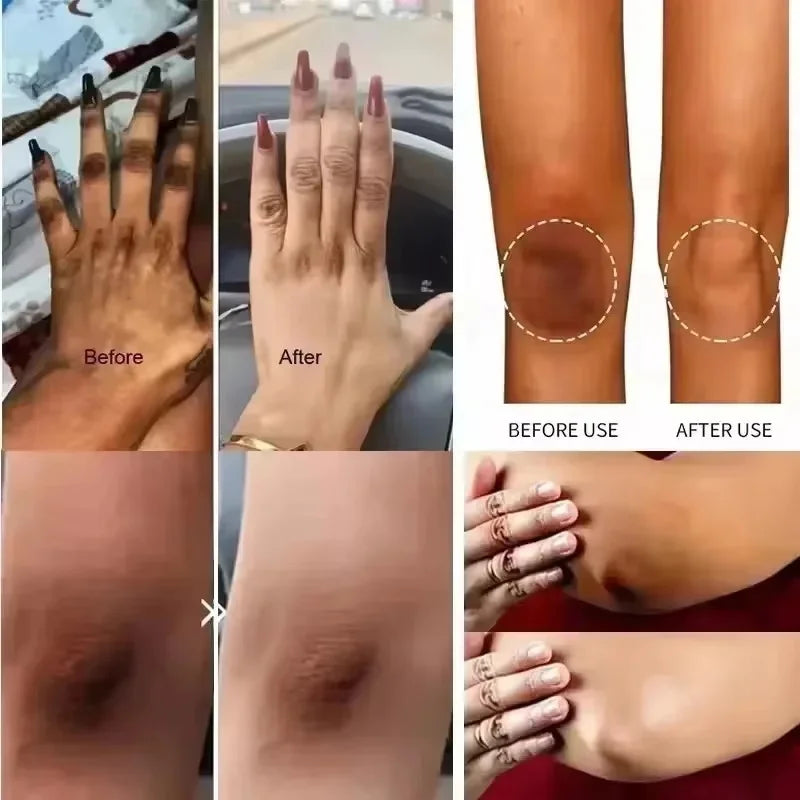 Retinol Brightening Cream – Underarm, Neck & Body Skin Tone Brightening Body Cream Qme