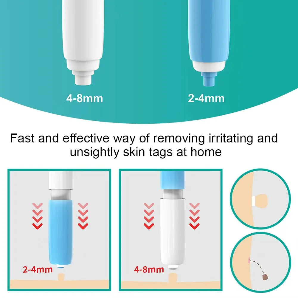 2-in-1 Skin Tag Removal Kit – Band Device for Face & Body Skin Tag Removal Kit Qst