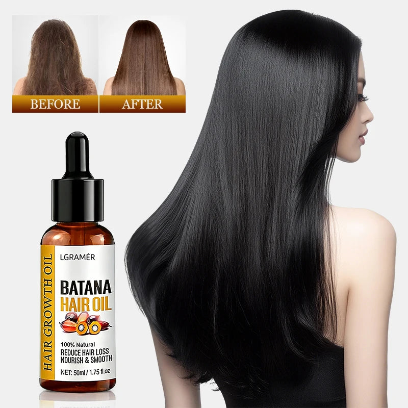 YOUNGCOME Batana Hair Growth Oil – Nourish & Strengthen, 50ml Hair Growth Oil Qst
