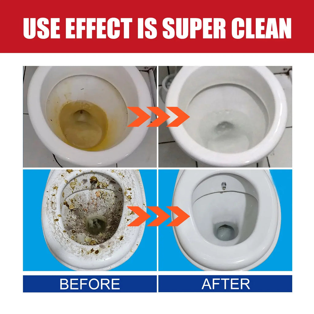 Toilet Bowl Cleaner Effervescent Tablets – Stain & Odor Remover Toilet Cleaning Tablet Qme