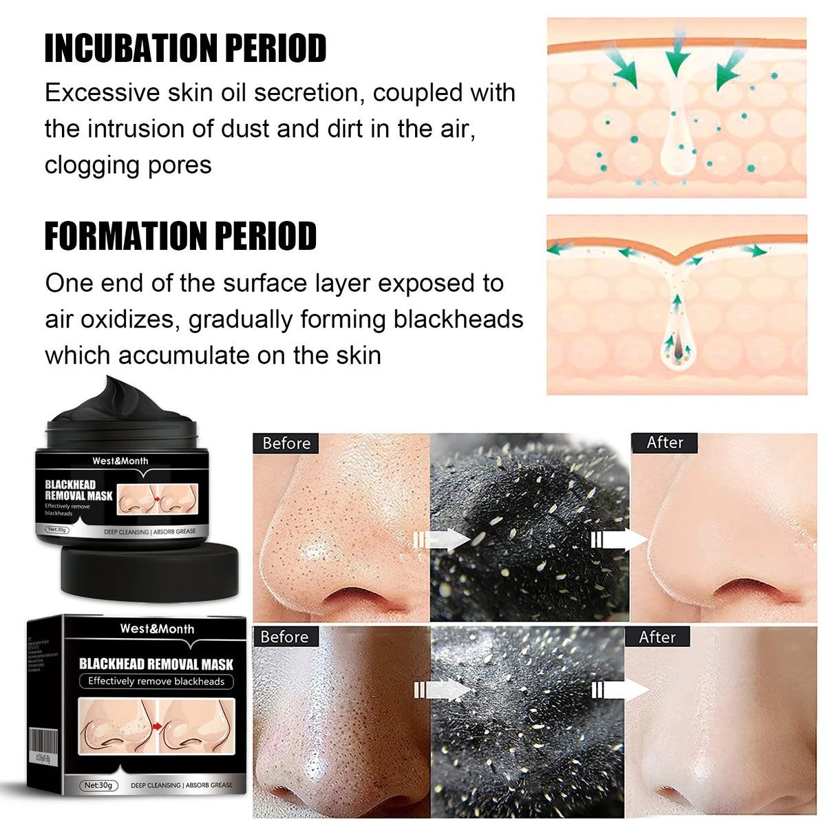 Activated Carbon Peel-Off Blackhead Mask – All Skin Types Peel-Off Face Mask Qst