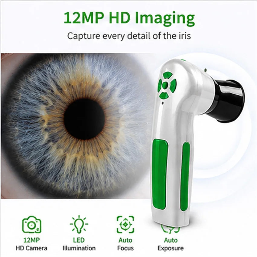 Suyzeko 12MP WiFi Iris Scanner Camera – Iridology Analyzer Iris Scanner Camera Qst