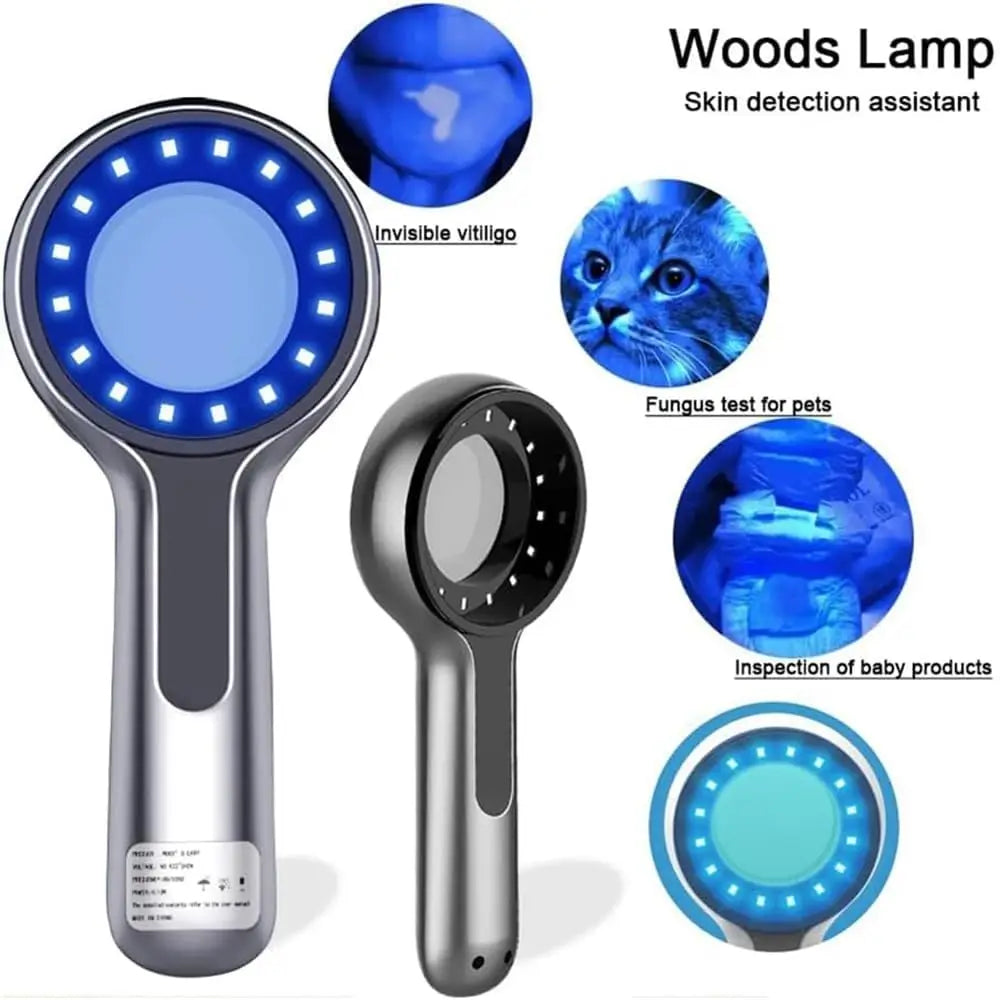 Wood's Lamp Skin Analyzer – 365nm UV, 16 LED, 4000mAh UV Skin Analyzer Qst