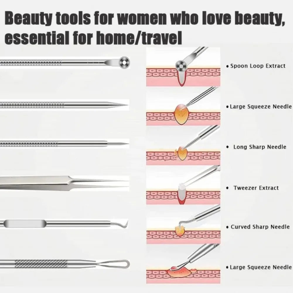 Stainless Steel Comedone Extractor & Blackhead Remover Tool Set Skin Care Tool Set Qme