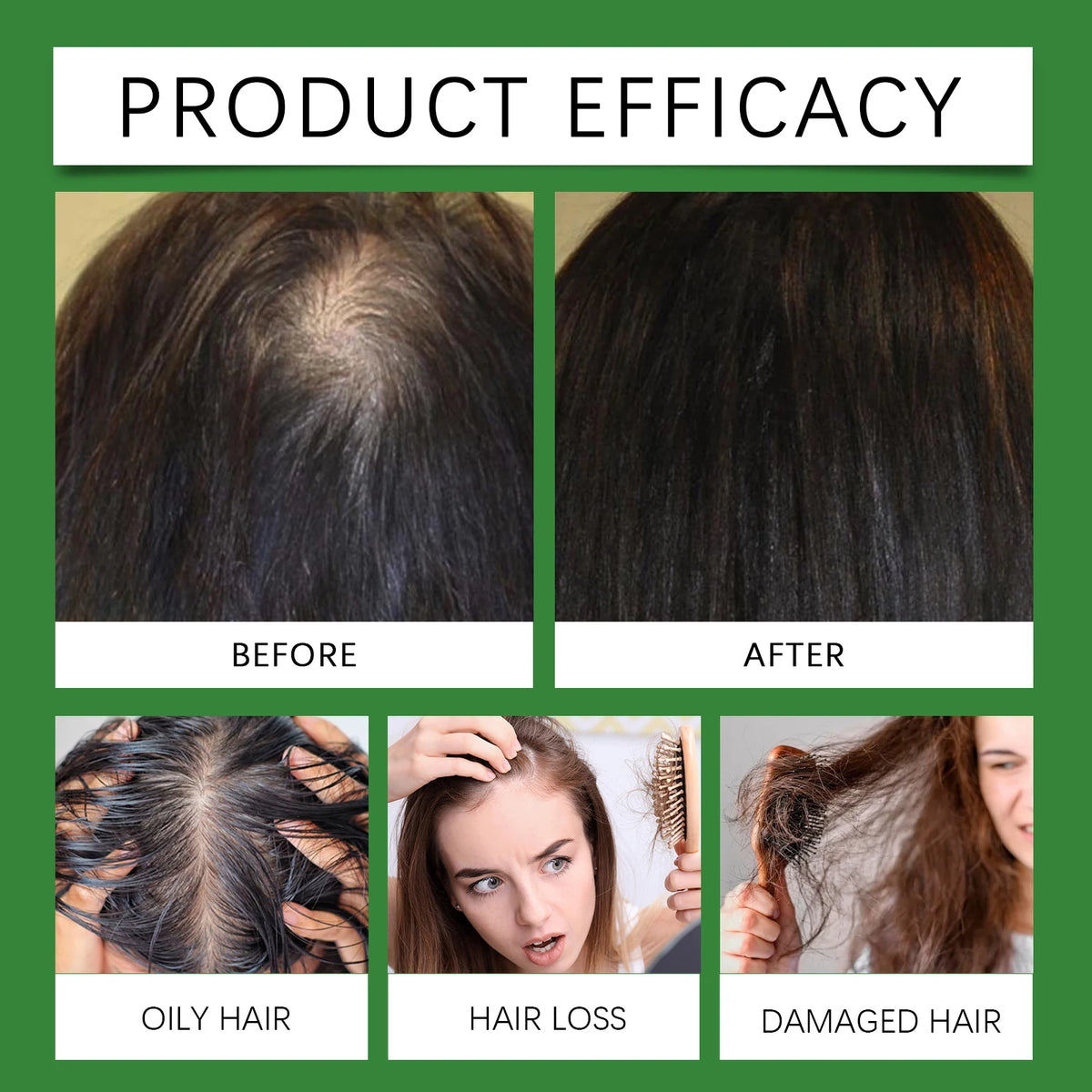 Rosemary Rice Water Hair Mist – Nourish, Smooth & Strengthen Leave-In Hair Spray Qst