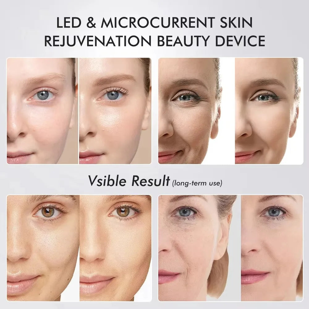 Vilnason 6-in-1 EMS Facial Beauty Device | LED Light Therapy Facial Beauty Device Qst