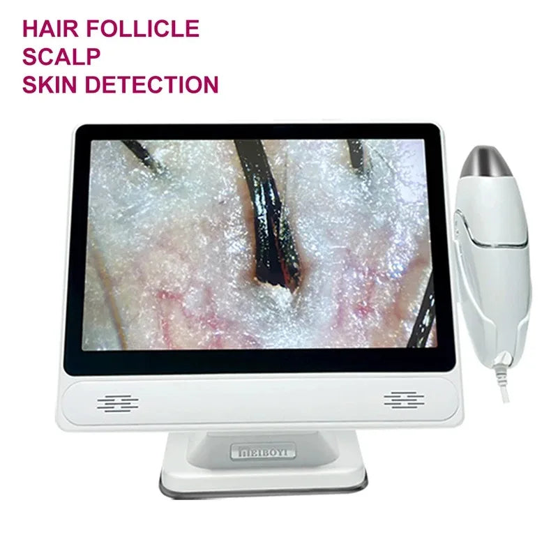 HD Hair Scalp Camera & Digital Skin Analyzer – 10" Screen Scalp Skin Analyzer Qst
