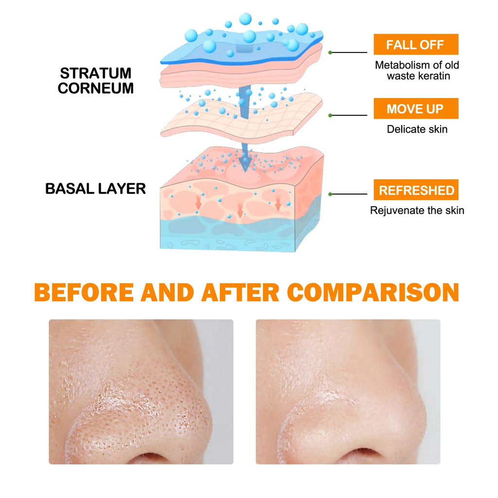 Hoygi Niacinamide Exfoliating Gel – Pore Minimizing Cleanser Exfoliating Face Cleanser Qst
