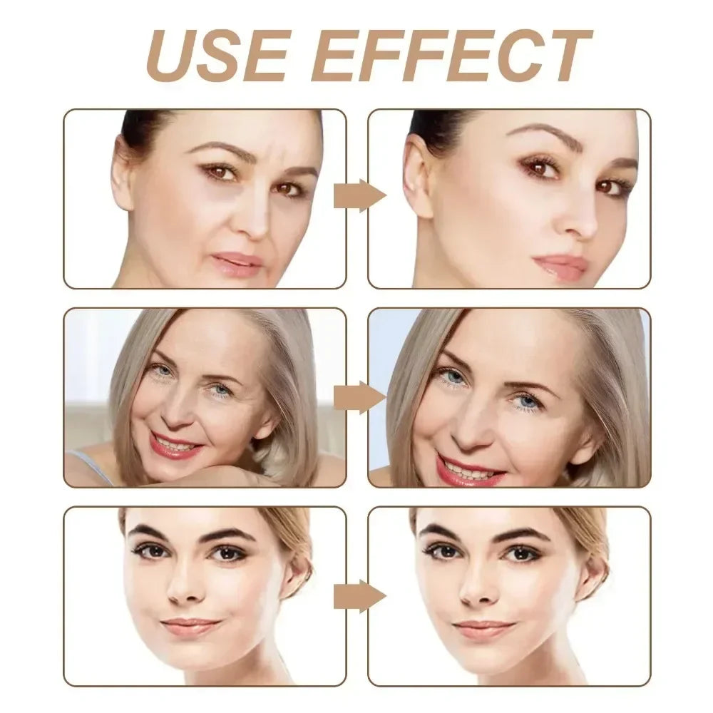 Facial Kinesiology Lifting Tape – V-Line, Neck & Eye Facial Lifting Tape Qme