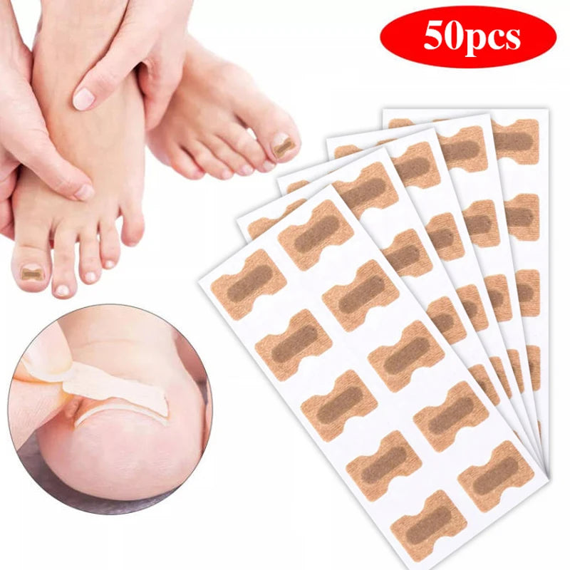 Toenail Correction Strips – Waterproof Pedicure Tool 10/100 Pcs Toenail Correction Strips Qst 5 Sheet (50 PCS)