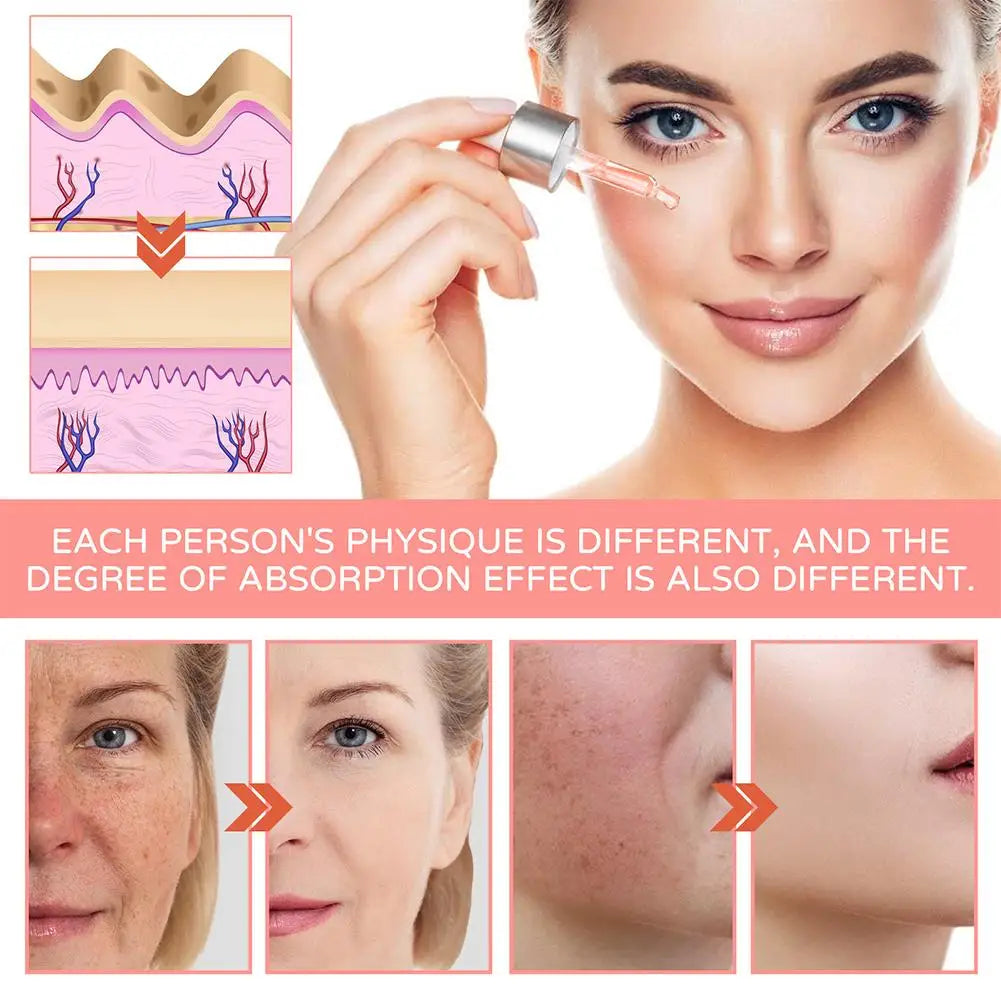 Vitamin C Face Serum – Hydrating, Brightening & Anti-Wrinkle Vitamin C Face Serum Qme