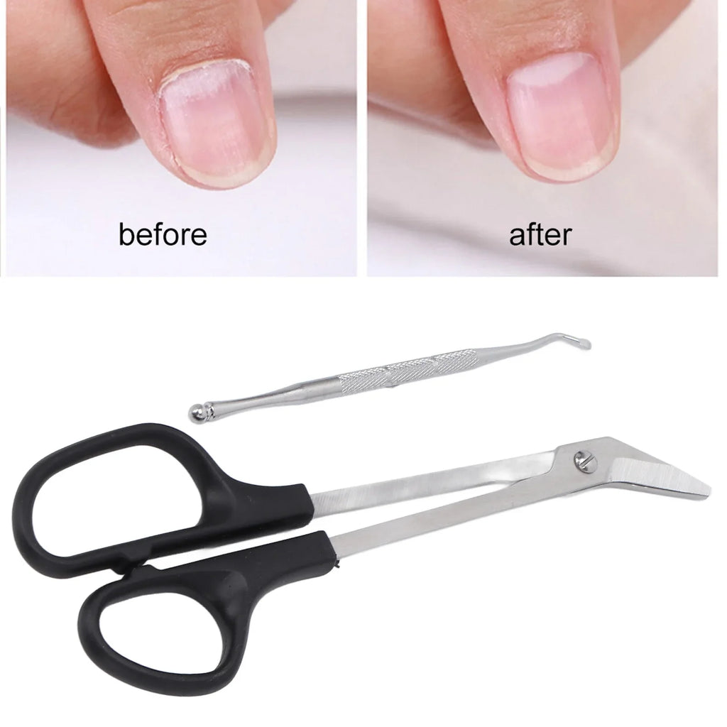 Long Handle Toenail Clippers – Ergonomic Stainless Steel Scissors Toenail Clippers Qme