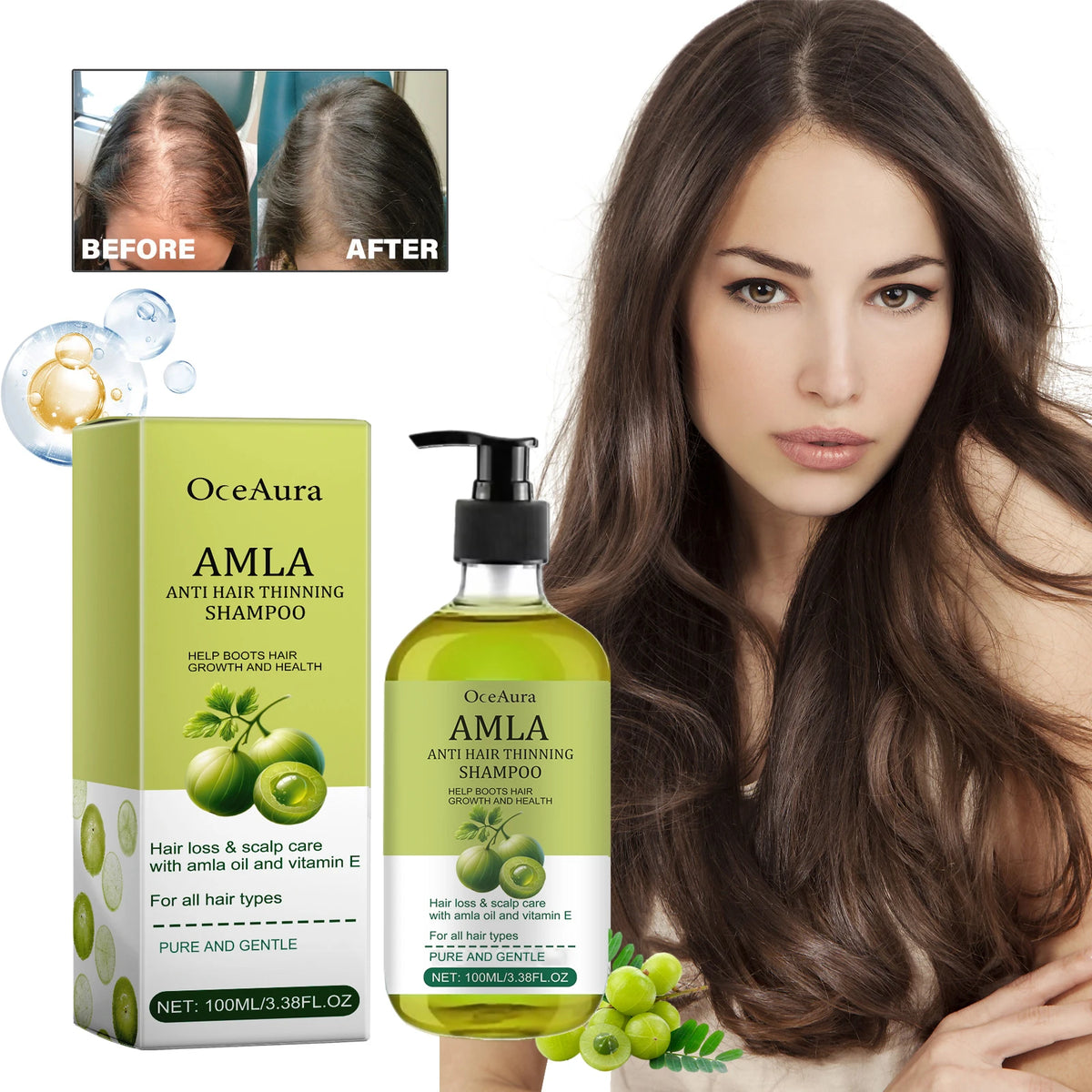 OceAura Amla Oil Shampoo – Volumizing & Strengthening Hair Growth Shampoo Qst