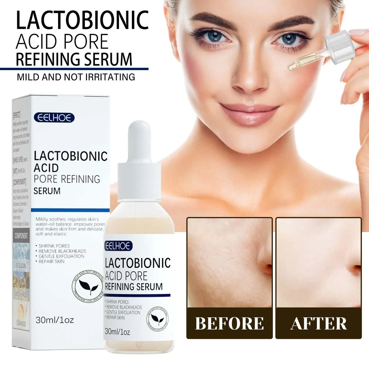 Lactic Acid Pore-Minimizing Serum | Blackhead & Moisture Boost Facial Serum Qme