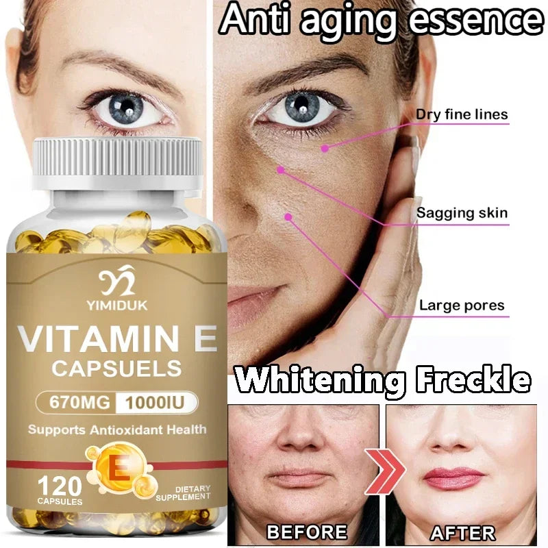 Yimiduk Vitamin E 670mg Capsules 120ct – Skin Hair & Eye Support Vitamin Supplement Qst