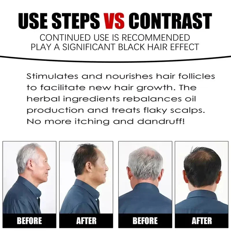 Herbal Hair Dye Shampoo – Dark Color & Nourishing Treatment Hair Dye Shampoo Qme
