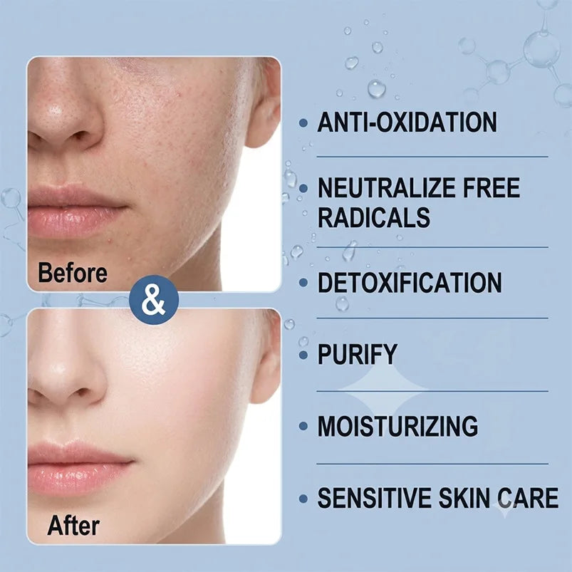 Nano Hydrogen Facial Mist Sprayer – USB Rechargeable Skin Care Facial Mist Sprayer Qst