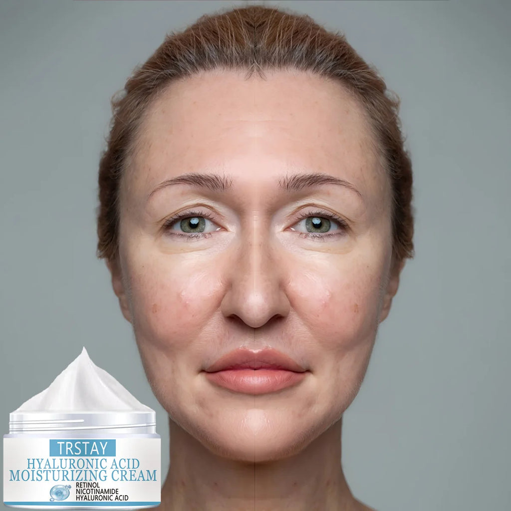 TRSTAY Hyaluronic Acid Cream – Retinol & Nicotinamide Face Moisturizing Cream Qst 30g