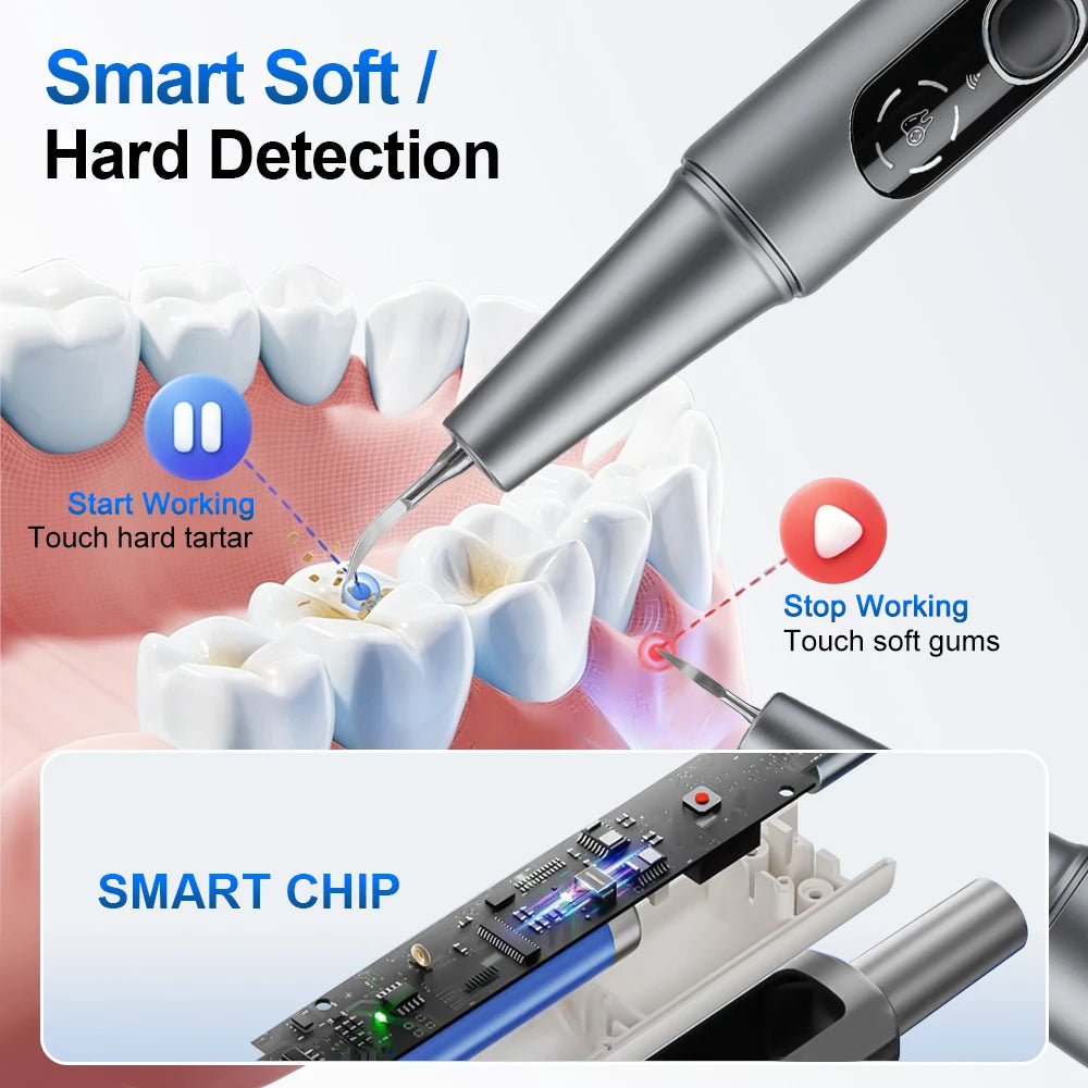 Ultrasonic Dental Scaler HD Camera LED Light – 5 Modes Ultrasonic Dental Scaler Qst