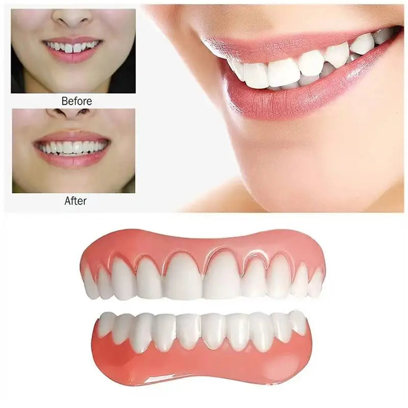 Silicone Denture Set – Flexible Upper & Lower Veneers Cosmetic Dental Veneers Qme