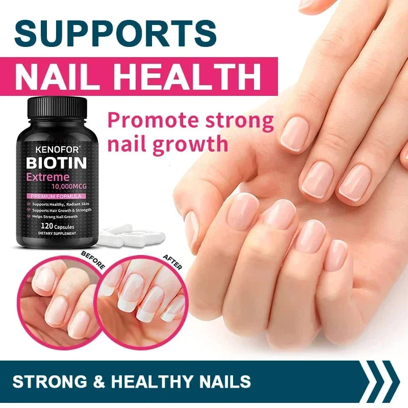 Kenofor Biotin Capsules – Hair, Skin & Nail Supplement Biotin Supplement Qst