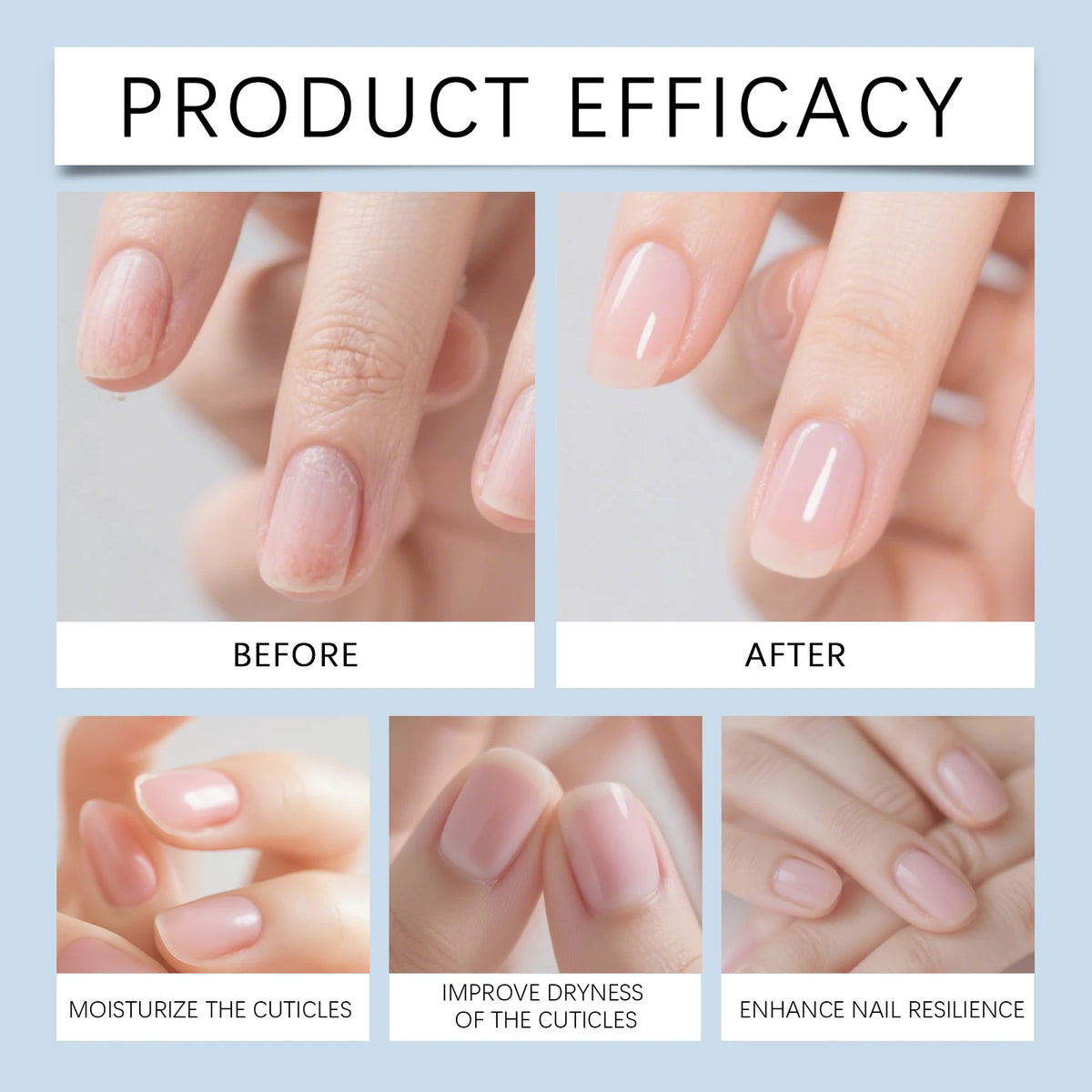 Cherry Cuticle Oil Pen – Nail Nourishment & Strengthening Treatment Cuticle Oil Pen Qst