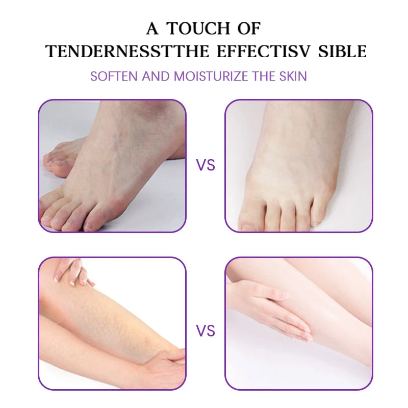 YOUNGCOME Lavender Foot Cream – Nourishing Heel & Foot Balm Foot Cream Qst