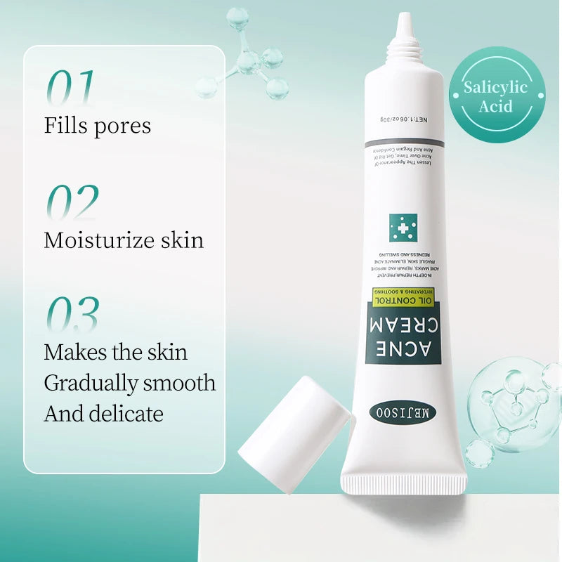 Salicylic Acid Face Cream – Pore Minimizing & Oil Control 30g Salicylic Acid Cream Qst