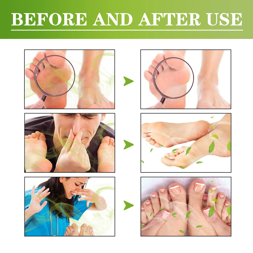 South Moon Lavender Foot Deodorizing Aromatherapy Spray 30ml Foot Deodorizing Spray Qst