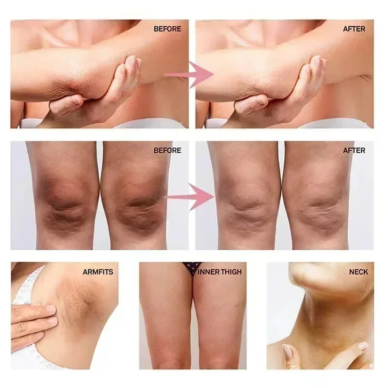 Brightening Serum Cream – Underarm, Knee & Intimate Areas Brightening Body Serum Qme