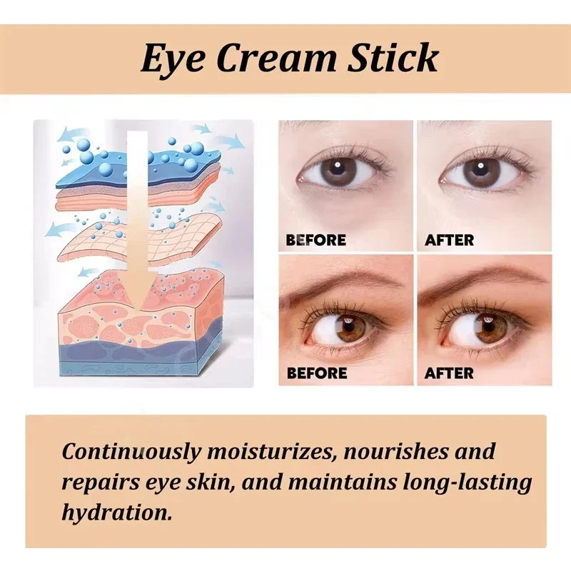 Retinol Eye Serum Roller | Rolling Bead Massage Eye Care Eye Serum Roller Qme
