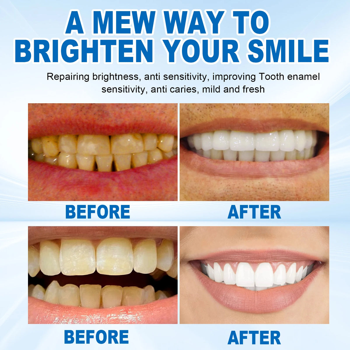 PWYUMAN Probiotic Whitening Toothpaste – 100g Dental Cleanser Whitening Toothpaste Qst
